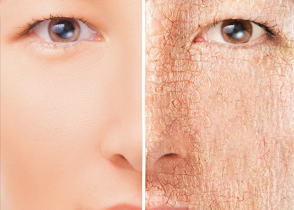 sensitive skin foundation